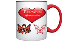 Load image into Gallery viewer, Brain Aneurysm Awareness