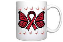 Load image into Gallery viewer, HIV: Died